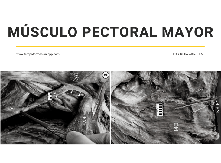 musculo-pectoral-mayor-variantes-anatomicas